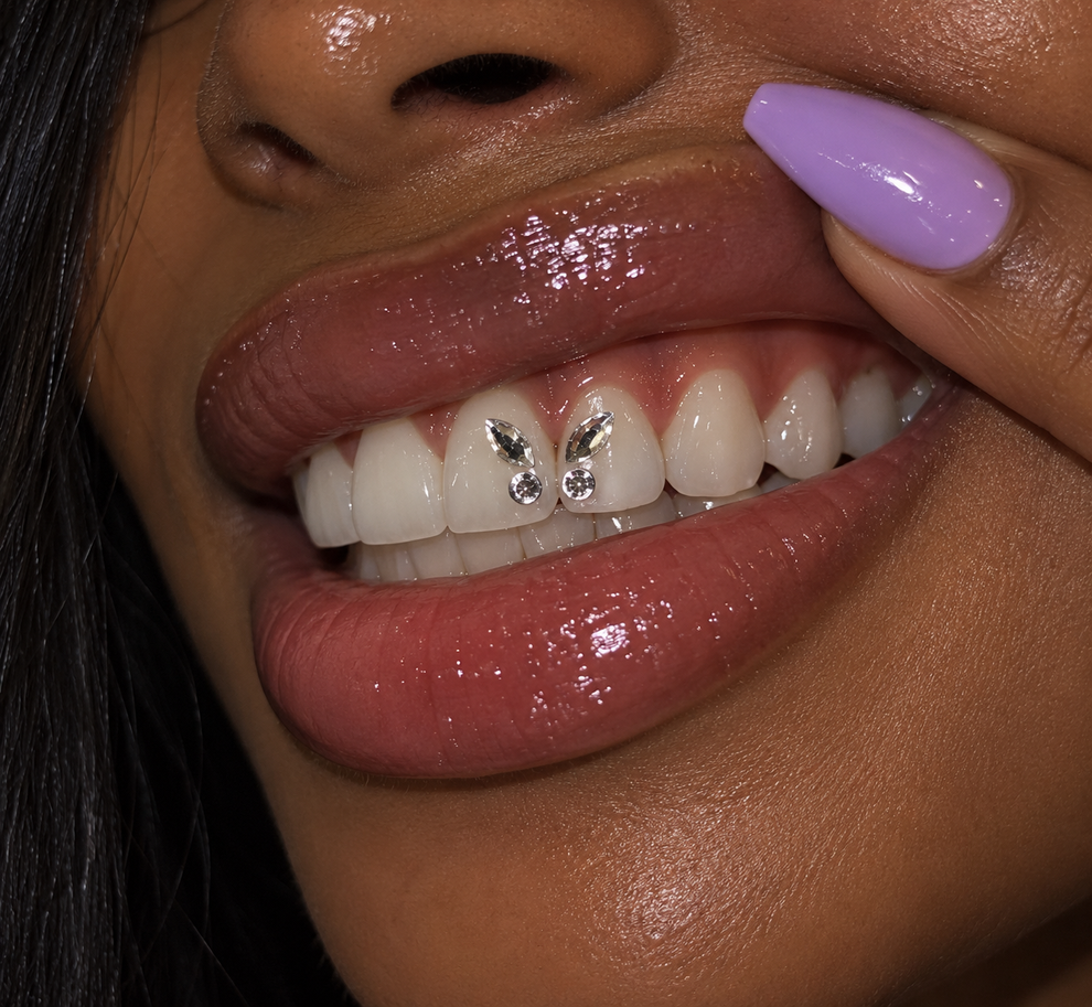 Butterfly Tooth Gems – ICEDXJANS