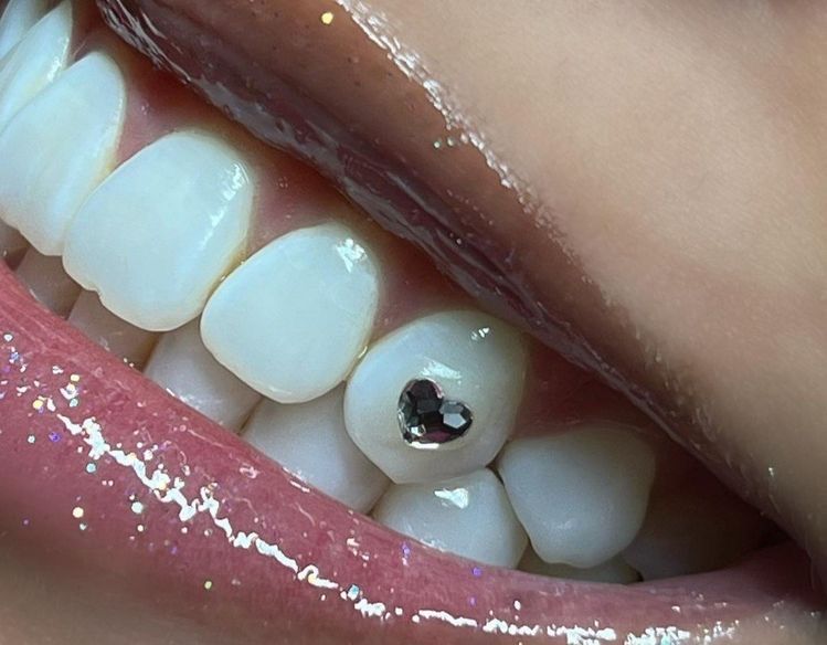 Heart Tooth Gems – ICEDXJANS