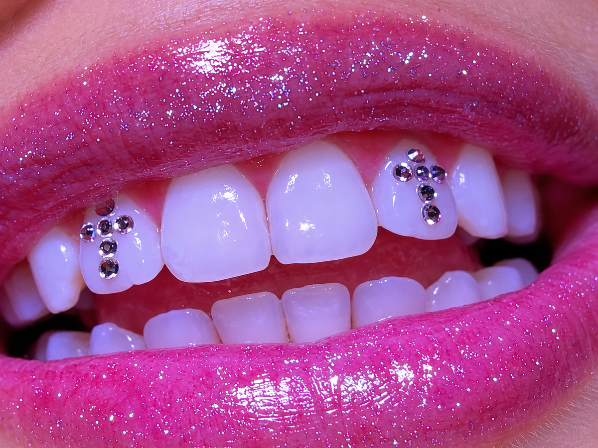 Cross Tooth Gems – ICEDXJANS